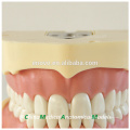 BF Tipo Screw Teeth Dental Study Model 13005, Terno de dentes de substituição para Frasaco Jaw